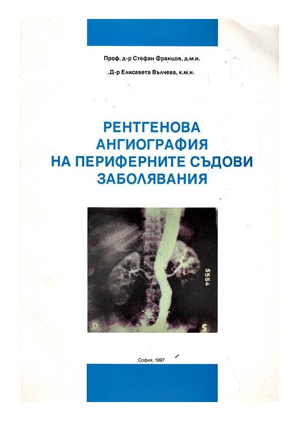 Рентгенова агиография на периферните съдови заболявания